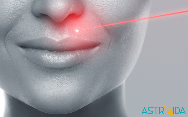 Laser Hair Removal